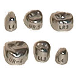 Stainless Steel Permanent 1st Molar Crowns