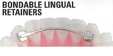 Bondable Lingual Retainers