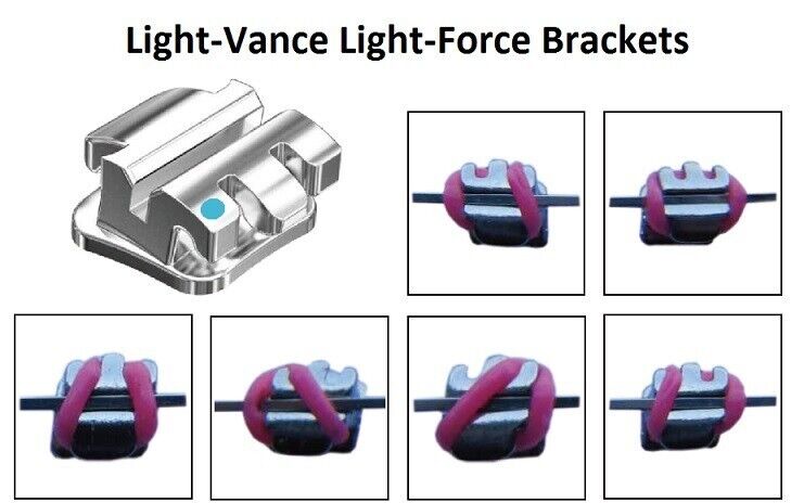 Light-Vance Light Force Brackets