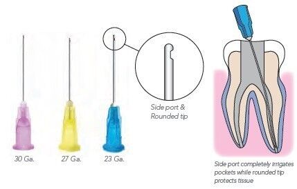 OptiProbe Side Open Closed End Needle Tips - PacDent