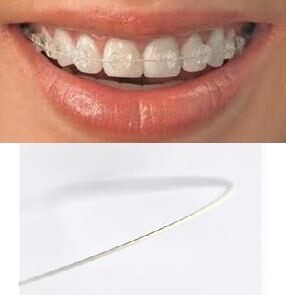 Tooth Tone Coated Stainless-Steel Archwire