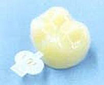 Molar Polycarbonate Temporary Crowns - Directa