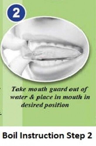 Dental Mouth Guard - Step 2