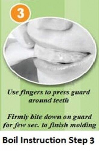 dental mouth Guard step 3