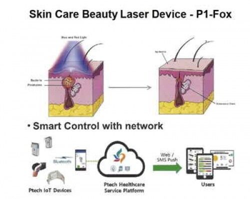 Skin Care Beauty Device - P1-Fox
